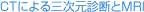 見出し｜CTによる三次元診断とMRI