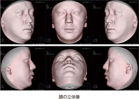 画像｜顔の立体像