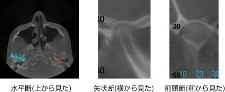 画像｜顔の断面像1