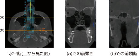 画像｜顔の断面像2