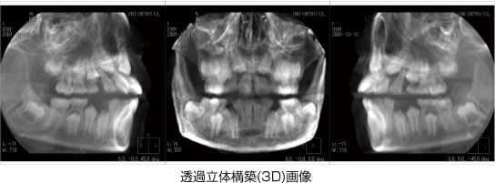 画像｜透過立体構築（3D）画像