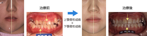 画像｜顔面非対称