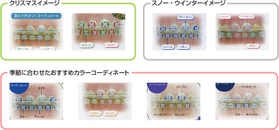 画像｜コーディネートの例