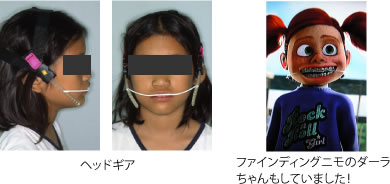 画像｜ヘッドギア