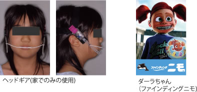 画像｜ヘッドギア