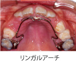 画像｜ヘッドギア