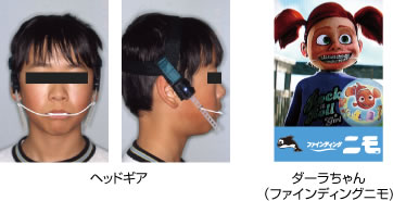 画像｜ヘッドギア