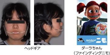 画像｜ヘッドギア